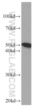 Fibrinogen beta chain Antibody in Western Blot (WB)