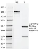 Fascin-1 (Reed-Sternberg Cell Marker) Antibody in SDS-PAGE (SDS-PAGE)