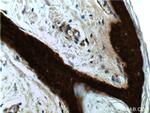 14-3-3 sigma Antibody in Immunohistochemistry (Paraffin) (IHC (P))