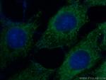 SFRP2 Antibody in Immunocytochemistry (ICC/IF)