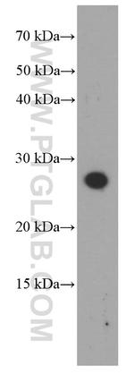 Dermatopontin Antibody in Western Blot (WB)