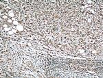 MMP2 Antibody in Immunohistochemistry (Paraffin) (IHC (P))