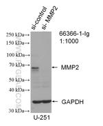 MMP2 Antibody in Western Blot (WB)