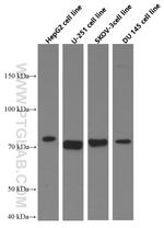 MMP2 Antibody in Western Blot (WB)