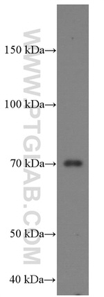 MMP2 Antibody in Western Blot (WB)