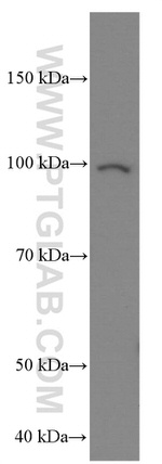 MMP2 Antibody in Western Blot (WB)