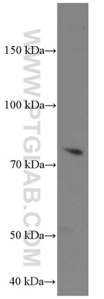 MMP2 Antibody in Western Blot (WB)