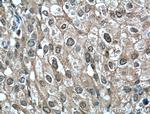 Phospho-AKT (Ser473) Antibody in Immunohistochemistry (Paraffin) (IHC (P))