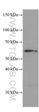 Phospho-AKT (Ser473) Antibody in Western Blot (WB)