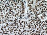 SP1 Antibody in Immunohistochemistry (Paraffin) (IHC (P))