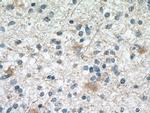 SMAD1 Antibody in Immunohistochemistry (Paraffin) (IHC (P))