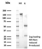 SOX9/SRY-box 9 Antibody in SDS-PAGE (SDS-PAGE)