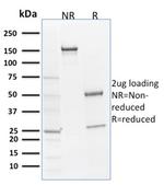 SOX9/SRY-box 9 Antibody in SDS-PAGE (SDS-PAGE)