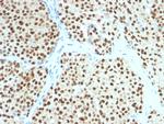 SOX10 (Melanoma Marker) Antibody in Immunohistochemistry (Paraffin) (IHC (P))