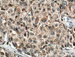 IL1 beta Antibody in Immunohistochemistry (Paraffin) (IHC (P))