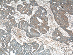 IL1 beta Antibody in Immunohistochemistry (Paraffin) (IHC (P))