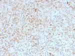 SPARC/Osteonectin Antibody in Immunohistochemistry (Paraffin) (IHC (P))