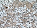 SOCS3 Antibody in Immunohistochemistry (Paraffin) (IHC (P))