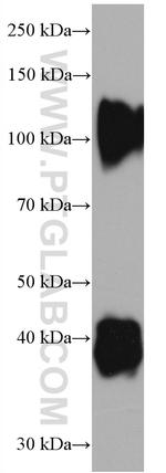 Decorin Antibody in Western Blot (WB)