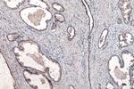 SMO Antibody in Immunohistochemistry (Paraffin) (IHC (P))