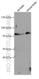 SMO Antibody in Western Blot (WB)