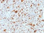 PU.1 (SPI-1) (B-Cell Marker) Antibody in Immunohistochemistry (Paraffin) (IHC (P))