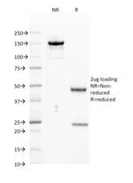 PU.1 (SPI-1) (B-Cell Marker) Antibody in SDS-PAGE (SDS-PAGE)