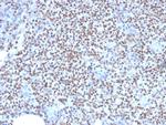 PU.1 (SPI-1) Antibody in Immunohistochemistry (Paraffin) (IHC (P))