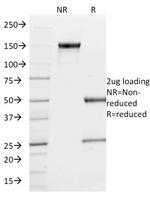 PU.1 (SPI-1) Antibody in SDS-PAGE (SDS-PAGE)