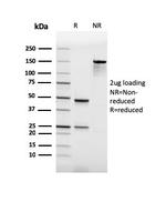 PU.1 (SPI-1) (B-Cell Marker) Antibody in SDS-PAGE (SDS-PAGE)