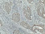SPTLC1 Antibody in Immunohistochemistry (Paraffin) (IHC (P))