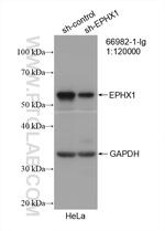 EPHX1 Antibody in Western Blot (WB)