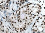 CTBP1 Antibody in Immunohistochemistry (Paraffin) (IHC (P))