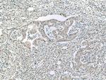 ASK1 Antibody in Immunohistochemistry (Paraffin) (IHC (P))