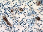 Endoglin/CD105 Antibody in Immunohistochemistry (Paraffin) (IHC (P))