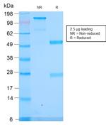 Spectrin Alpha 1 Antibody in SDS-PAGE (SDS-PAGE)