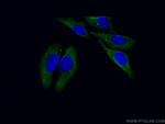 LOXL2 Antibody in Immunocytochemistry (ICC/IF)