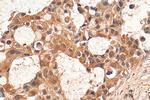 HDAC6 Antibody in Immunohistochemistry (Paraffin) (IHC (P))