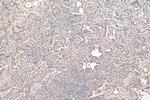 HDAC6 Antibody in Immunohistochemistry (Paraffin) (IHC (P))