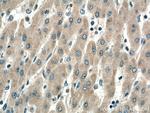 SIRT5 Antibody in Immunohistochemistry (Paraffin) (IHC (P))