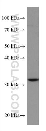 SIRT5 Antibody in Western Blot (WB)