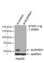 ALDH5A1 Antibody in Western Blot (WB)