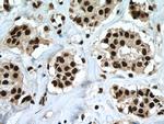 HNRNPH1 Antibody in Immunohistochemistry (Paraffin) (IHC (P))