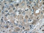 Caspase 4 Antibody in Immunohistochemistry (Paraffin) (IHC (P))