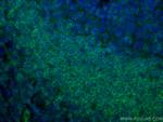 CD72 Antibody in Immunohistochemistry (Paraffin) (IHC (P))