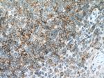 CD72 Antibody in Immunohistochemistry (Paraffin) (IHC (P))