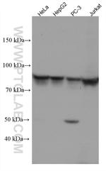 STAT4 Antibody in Western Blot (WB)