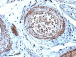 StAR (Steroidogenic Acute Regulator) (Leydig Cell Marker) Antibody in Immunohistochemistry (Paraffin) (IHC (P))