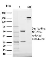 StAR (Steroidogenic Acute Regulator) Antibody in SDS-PAGE (SDS-PAGE)