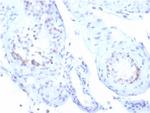 StAR (Steroidogenic Acute Regulator) (Leydig Cell Marker) Antibody in Immunohistochemistry (Paraffin) (IHC (P))